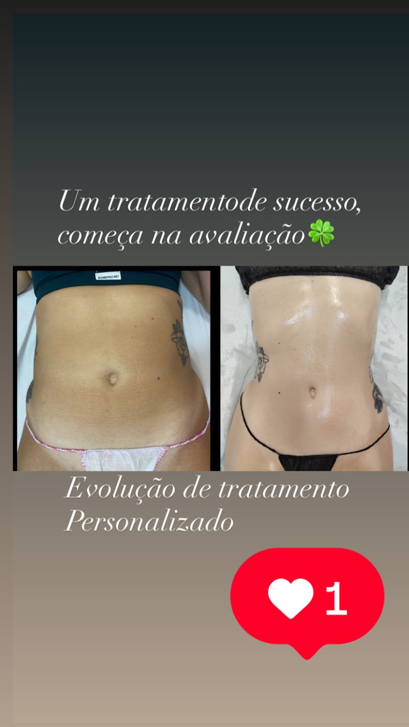 Camila Coelho Estética Avançada, beautician in Évora, Portugal, photo 4 of 10