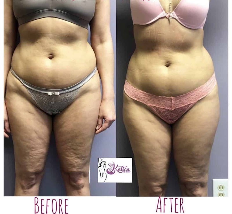 Katica Body Contour, spa in Elizabeth, NJ, photo 3 of 8