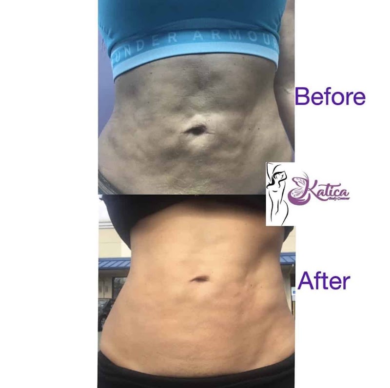 Katica Body Contour, spa in Elizabeth, NJ, photo 5 of 8