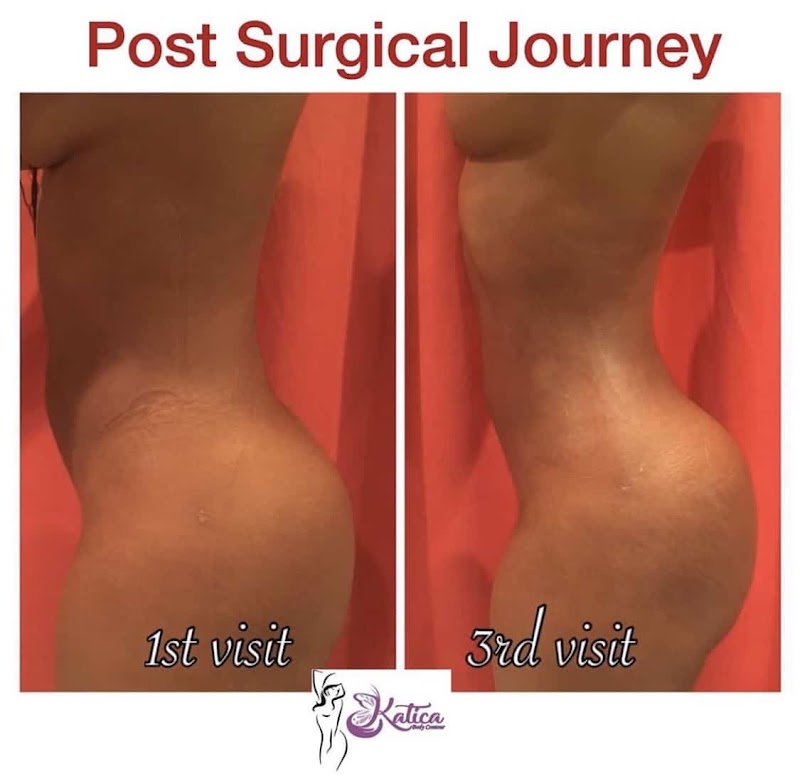 Katica Body Contour, spa in Elizabeth, NJ, photo 6 of 8
