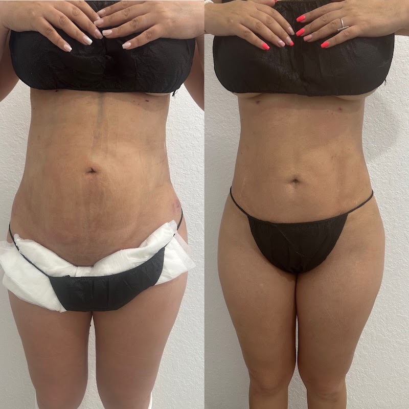 Yeny Masajes Linfático Spa, health in Florida City, FL, photo 1 of 10