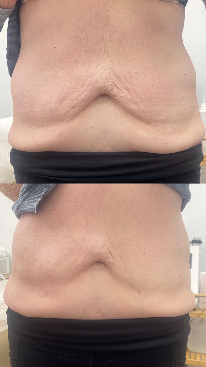 Oasis Body Sculpting, spa in Yucaipa, CA, photo 4 of 10
