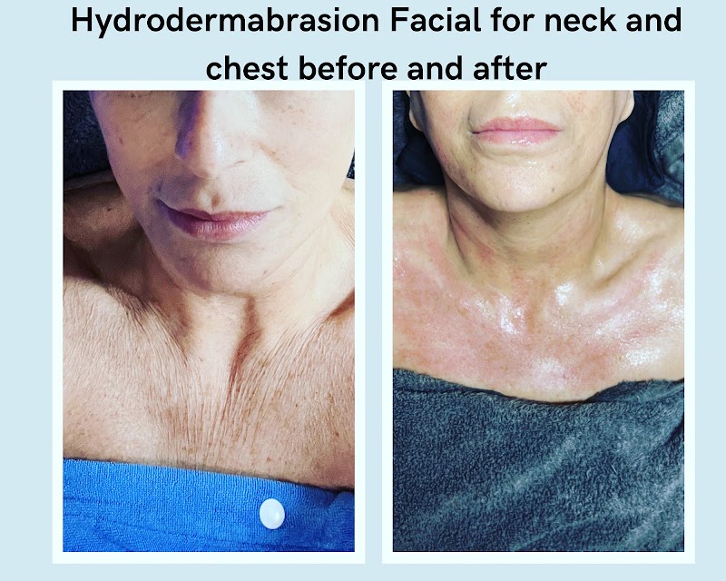 Heart of Beauty holistic Skin care by Grace, skin care clinic in Lemoore, CA, photo 2 of 10