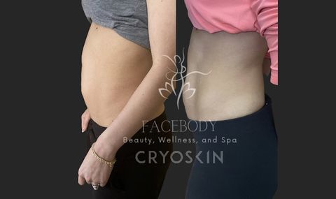FaceBody Beauty, Wellness, and Spa, spa in Moses Lake, WA