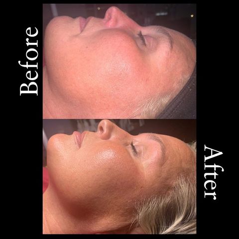 JustSkin with Rachel, spa in Gadsden, AL