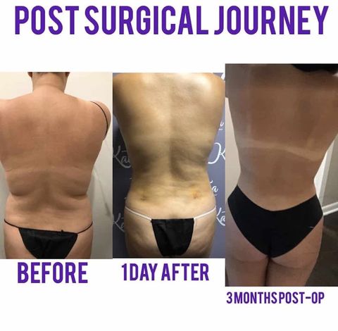 Katica Body Contour, spa in Elizabeth, NJ