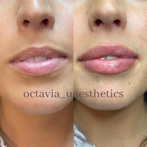 OctaviaUAesthetics, spa in Lufkin, TX