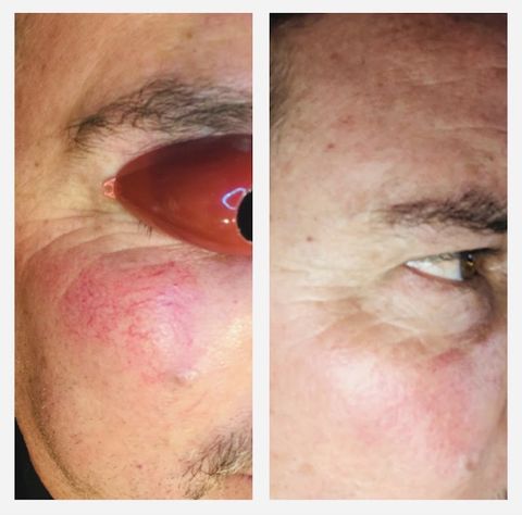 Refine Aesthetics, spa in Rock Springs, WY