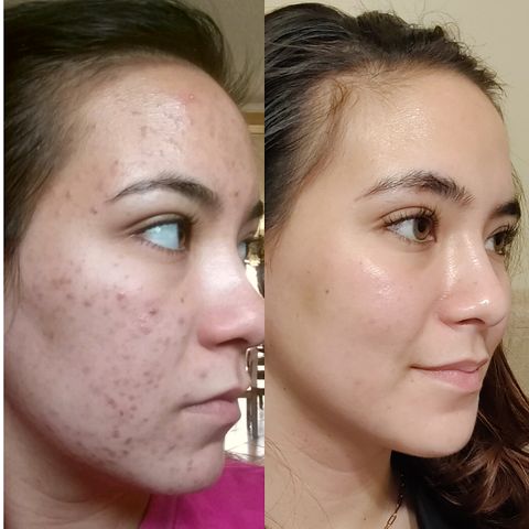 The KY Skin Specialist, spa in Murray, KY